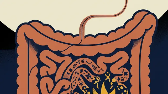 Intestino como sistema de alerta precoce para o Parkinson